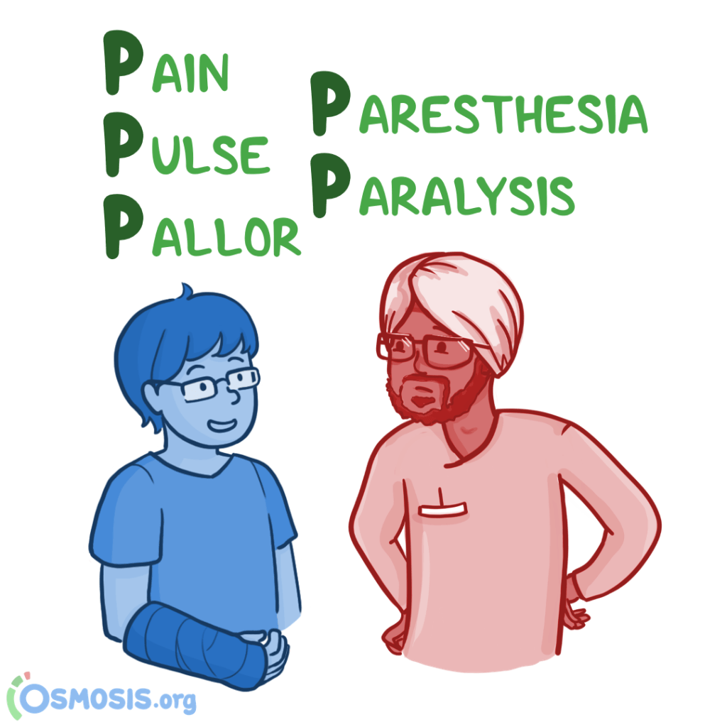 Pain
Pulse
Pallor
Paralysis
Paresthesia
