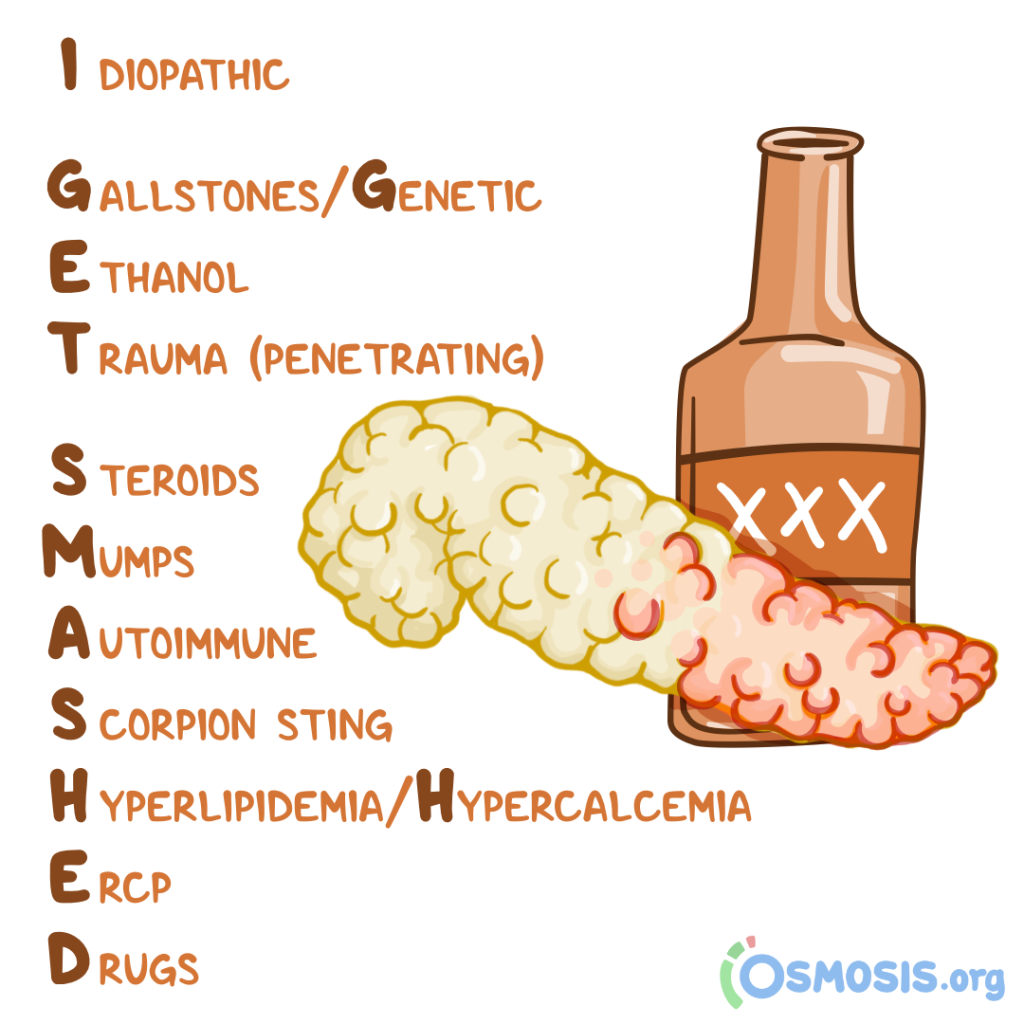Idiopathic
Gallstones
Ethanol
Trauma
Steroid use
Mumps
Autoimmune
Scorpion sting
Hypercalcemia/Hyperlipidemia
ECRP
Drugs