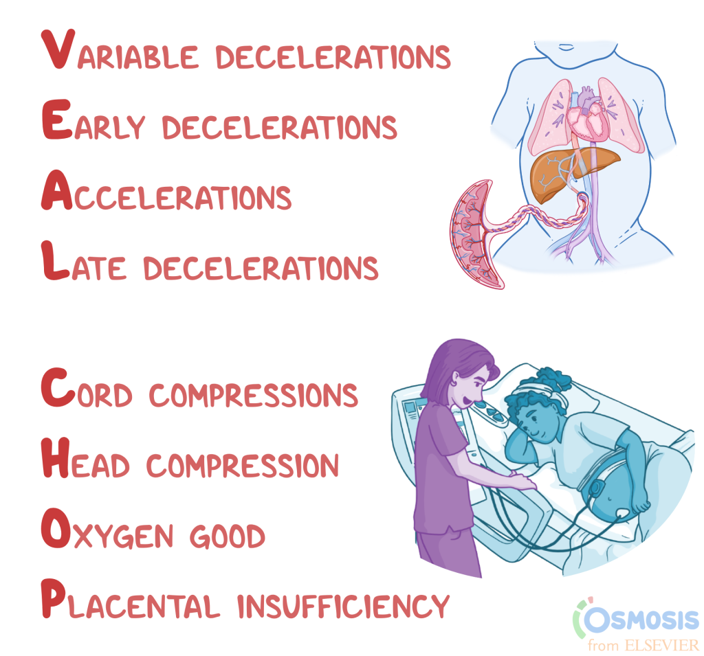 Variable decelerations — Change in cord
Early decelerations — Head compression
Accelerations — Oxygenation
Late decelerations — Placental insufficiency